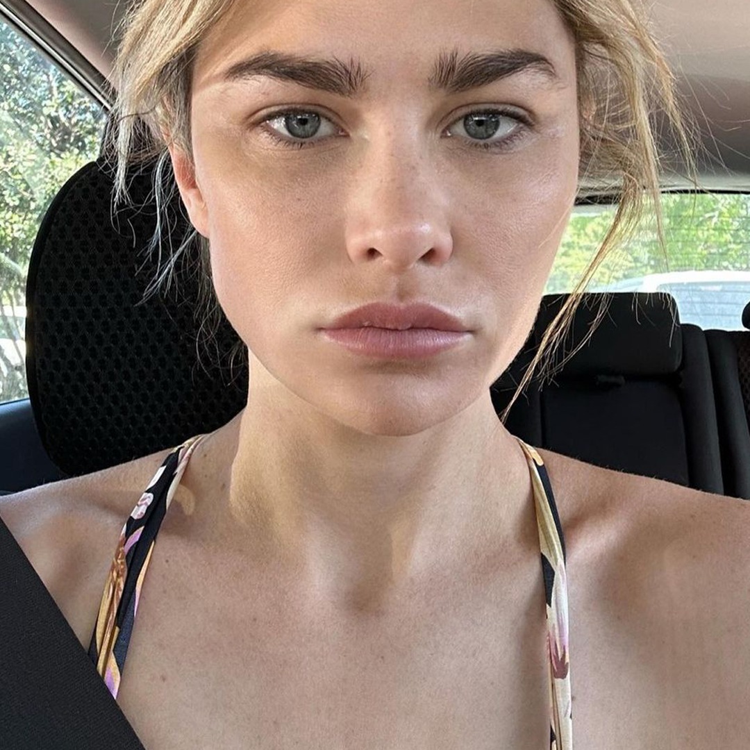 Bachelor Nation s Megan Marx Shares Rare Brain Disorder Diagnosis bachelor-nation-s-megan-marx-shares-rare-brain-disorder-diagnosis